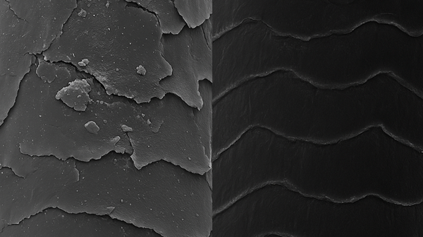 Build-up & Dandruff: The Hidden Dangers to Your Scalp & Hair Loss