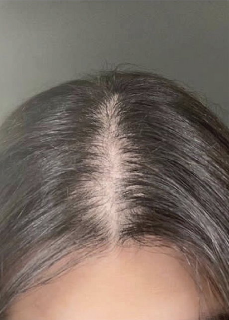Close-up of a person's hair with a visible center parting and thinning at the roots.